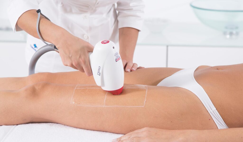 laser-hair-removal-be-laser-and-skin-clinic