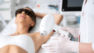 laser-hair-removal-taunton-treatment